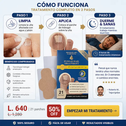 KIT 2 TRATAMIENTO HONGO FUNGAL NAIL — Parches de Hidrogel para Uñas + TRATAMIENTO PROFUNDO LIQUIDO|