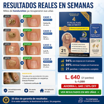 KIT 2 TRATAMIENTO HONGO FUNGAL NAIL — Parches de Hidrogel para Uñas + TRATAMIENTO PROFUNDO LIQUIDO|