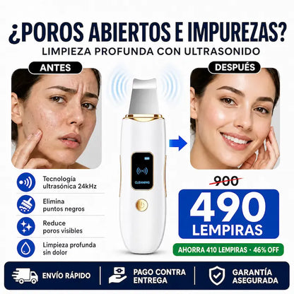Espátula Ultrasónica Facial GUGUG – Limpiador Profundo + Removedor de Impurezas SkinClean Pro – Espátula Ultrasónica Facial