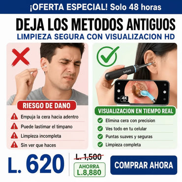 LIMPIADOR DE OÍDOS CON CÁMARA 4K Y LUZ LED GARANTÍA Y CERTIFICACIÓN
